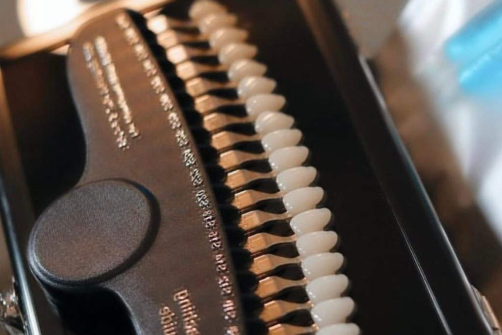 Dental tooth shade guide showing gradients from light to dark for cosmetic dental matching