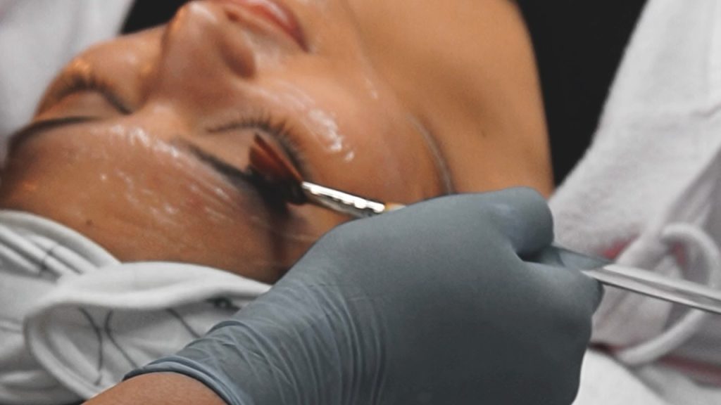 Aesthetician performing dermaplaning facial treatment on client using surgical blade for exfoliation